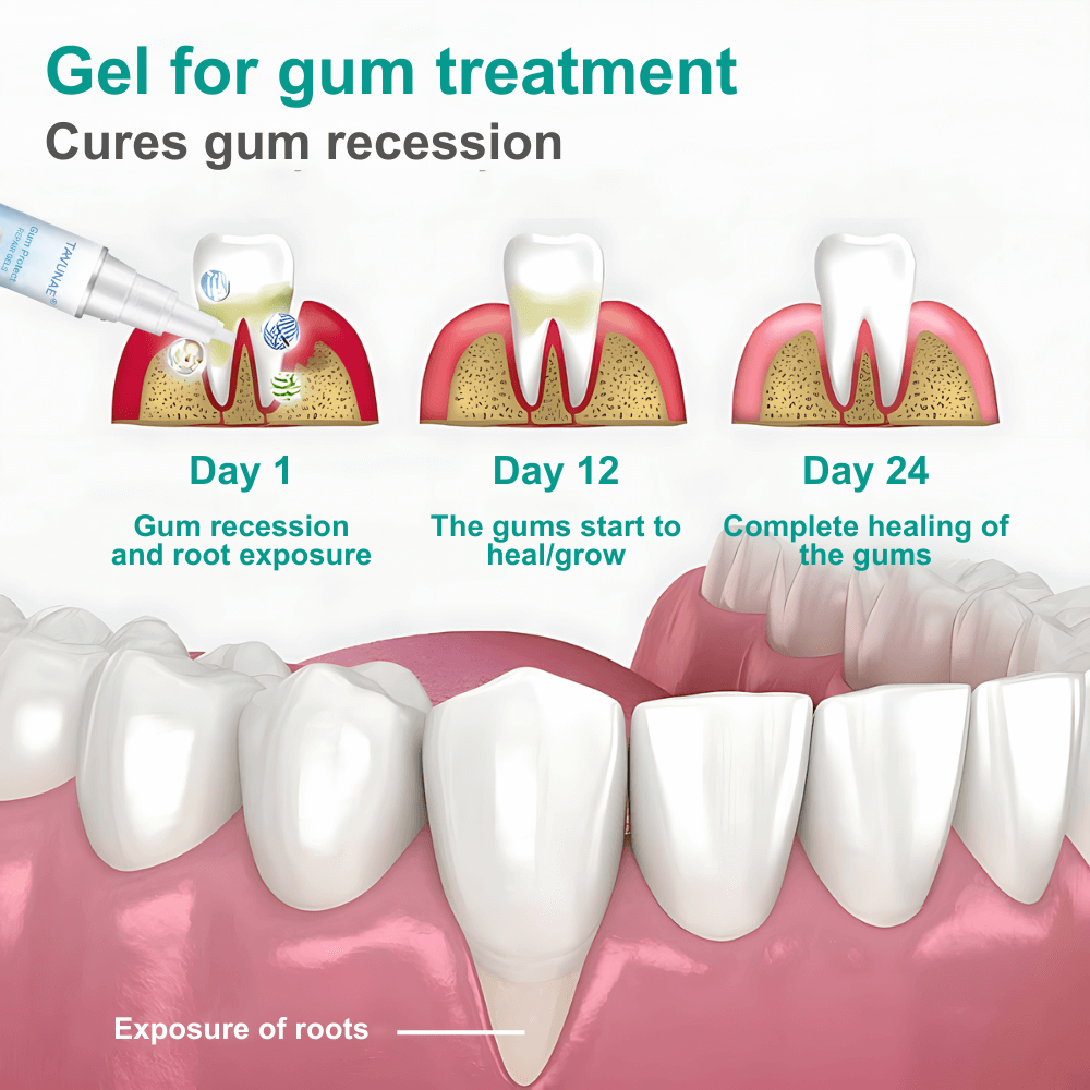 Tavunae® Teeth Repair Gel